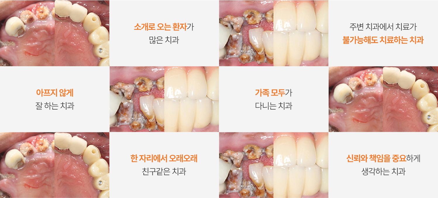 연세플란트치과의원 환자 치료 후기 살펴보기